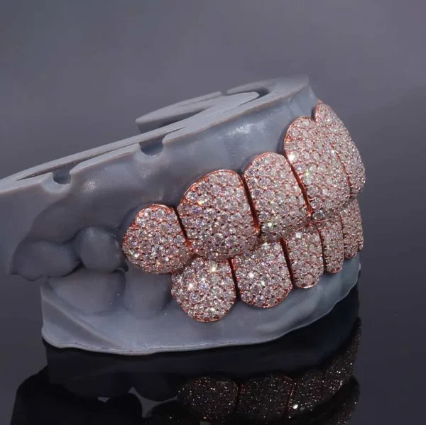 Rose Gold Perm Cut Custom Diamond Grillz 14K Gold - Image 2