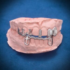 Custom Cross Opal Moissanite Grillz