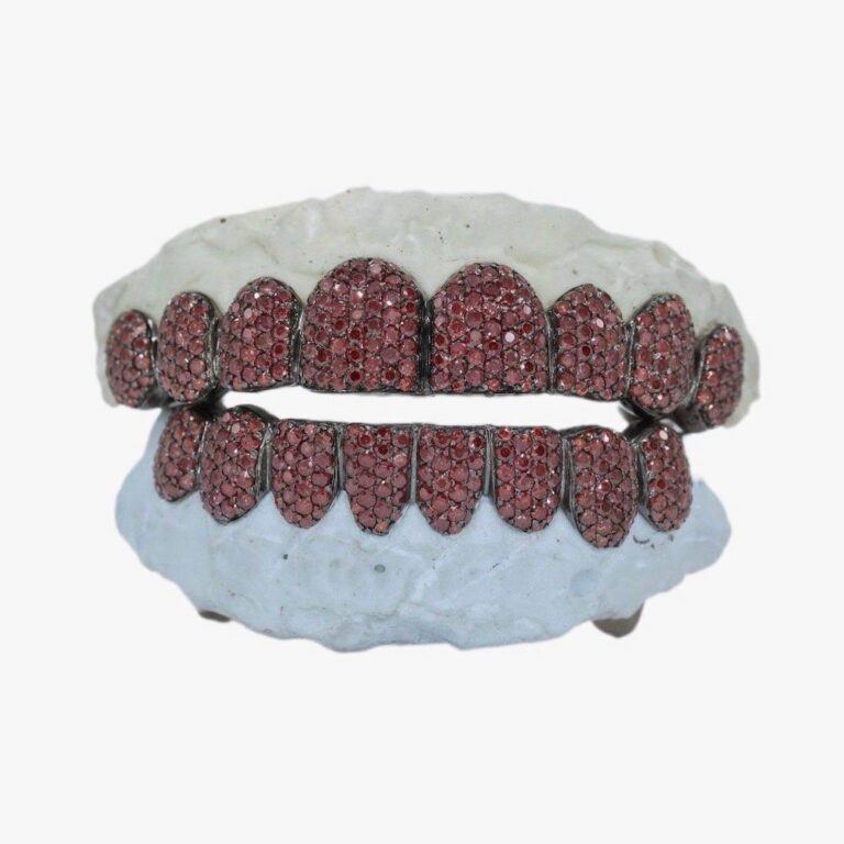red-moissanite-black-gold-grillz-first