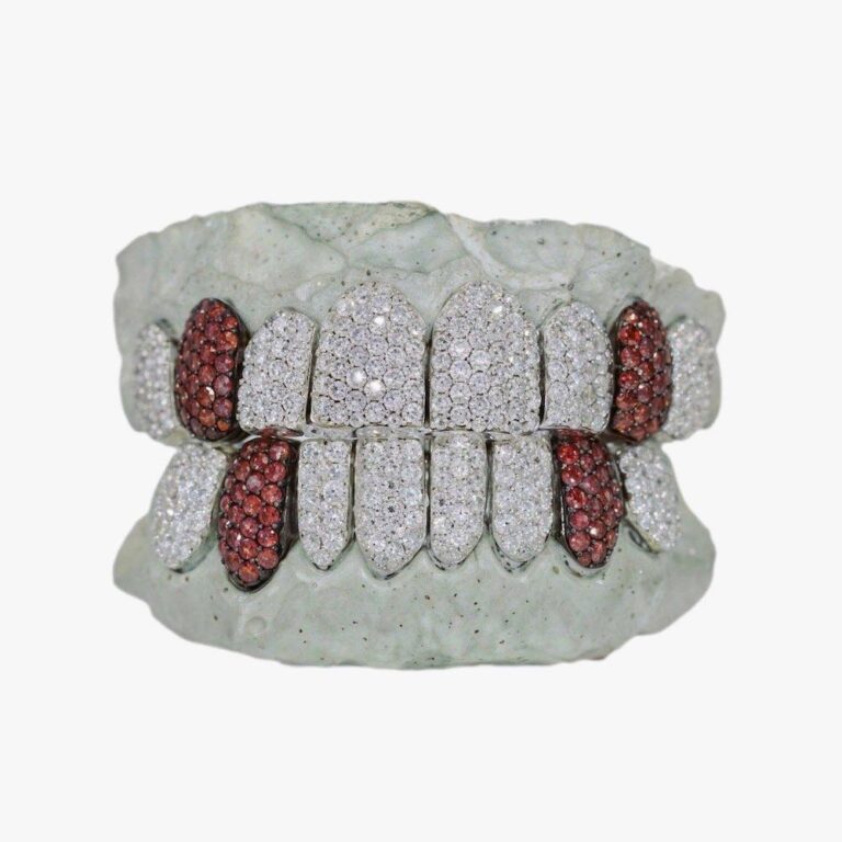 red-tusk-moissanite-grillz-14k-gold-first